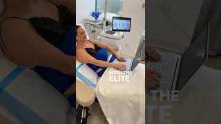 What to Expect CoolSculpting Treatment at AOB Med Spa medspa aobmedspa skincare [upl. by Medwin282]