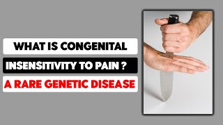 What is Congenital insensitivity to pain A Rare Genetic Disease [upl. by Yatnuhs279]