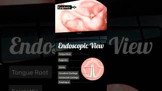 Anatomical view of throat larynx endoscopicprocedure voicebox anatomy trachea nursingstudent [upl. by Merrie]