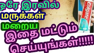 Skin tag or warts or maru remedy in Tamil how to remove skin tagswarts Tamil marukal poga tips [upl. by Schulz967]