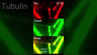 Microtubule weaving by tau droplets [upl. by Eem]