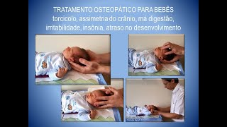 Bebê de 2 semanas Exame e tratamento pela Osteopatia craniossacral [upl. by Suzann]