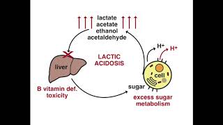 Lactic Acidosis description Analogy dirty aquarium [upl. by Honorine353]