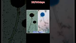 Rhizopus bacteria sudhanshuvlogs shorts minivlog dailyvlog [upl. by Laughlin]