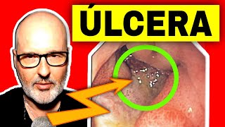 ÚLCERA GÁSTRICA o DUODENAL Síntomas Causas y Tratamiento [upl. by Allister]