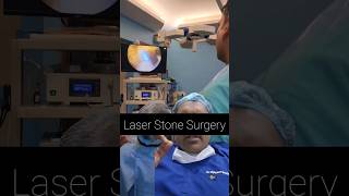 Kidney Stone का दुश्मन  Laser [upl. by Dareen636]