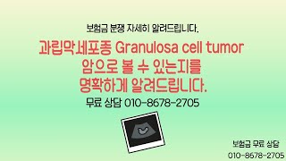 과립막세포종 Granulosa cell tumor 암으로 볼 수 있는지를 명확하게 알려드립니다 보험금 무료 상담 TEL 01086782705 과립막세포종난소과립막세포종 [upl. by Gnak]