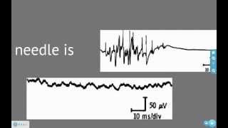 EMG and Action Potentials [upl. by Roel]