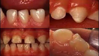 Radiology lec 7 part 1 dental and crainofacial anomalies جامعة بغداد طب اسنان مرحله ثالثه [upl. by Nemajneb]