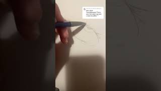 Pt 7  Trichotillomaniahair pulling disorder [upl. by Val]