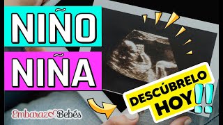 Cómo saber si es NIÑO o NIÑA por Ultrasonido  SEMANA 12 a 20 ¡Detecta las diferencias [upl. by Marceau]