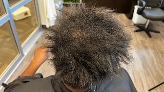 How to fix damaged hair  Stress is breaking her hair off [upl. by Kilroy]