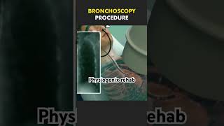 Bronchoscopy procedure shortsviral youtubeshort shortsfeed shortsyoutube youtubevideo youtuber [upl. by Mitchael774]