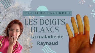 Le syndrome des doigts blancs Raynaud [upl. by Hillyer]