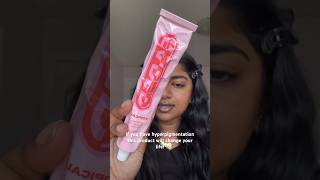 How to FIX a hyperpigmentation makeup beauty skincare [upl. by Worlock]