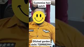 Customize hair patch hairst hairpatchindelhi hairaccessory hairwigservicesindelhi hairextension [upl. by Anyk]