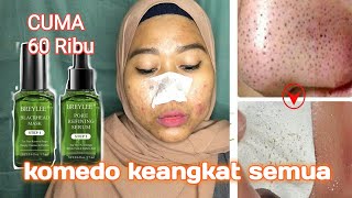 REVIEW MASKER KOMEDO VIRAL BREYLEE BLACKHEAD MASK DAN PORE REFINING SERUM [upl. by Llyrad]