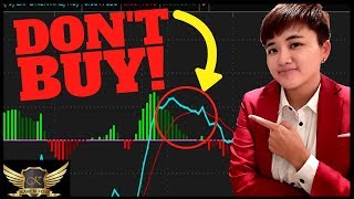 Learn MACD in 30 Minutes  ALL The Basics You Need [upl. by Folberth]