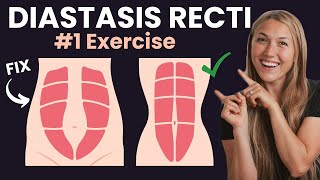 BEST Diastasis Recti Exercise To Strengthen Core  Postpartum Fitness Specialist [upl. by Loux]