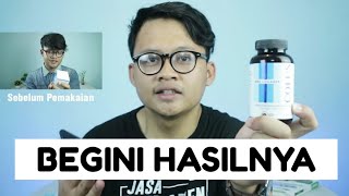 ERICKO LIM KW Review 30 Hari Pemakaian Suplemen Pemutih Kulit Pria COLUS MEN  AFAREZID [upl. by Yleoj336]