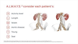 ALWAYS Hypogastric Artery Preservation Considerations [upl. by Nosnarb911]