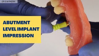 Abutment Level Implant Impression [upl. by Willabella]