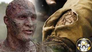 Greyscale Disease Explained  Game of Thrones Season 7 [upl. by Nerfe42]