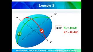 A Quick Guide to Reading Corneal Tomography Part 5 [upl. by Helene44]