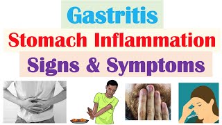 Gastritis Stomach Inflammation Signs amp Symptoms Complications amp Why They Occur [upl. by Wedurn963]