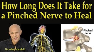 How Long Does It Take For A Pinched Nerve to Heal  Dr Mandell [upl. by Puna]