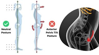 Pelvic Tilt Exercises For Lower Back Pain [upl. by Nosneh]