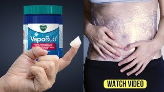 What Happens When You Use Vicks Vaporub  Unexpected Uses Of Vicks VapoRub [upl. by Eilrac]