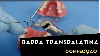 CONFECÇÃO DE BARRA TRANSPALATINA [upl. by Tryck]