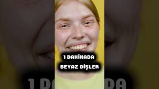 BİR DAKİKADA BEYAZ DİŞLER I İŞE YARAR BİLGİ [upl. by Refotsirc]