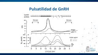 Modificaciones del Eje Hipotálamo Hipófisis Ovario  Fisiología  Casos IV [upl. by Whorton]