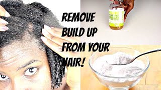 How To Clarify Your Hair And Scalp  Apple Cider Vinegar and Baking Soda [upl. by Akira946]