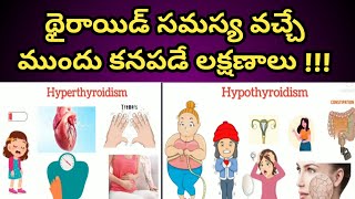 Thyroid Disease Symptoms in Teluguథైరాయిడ్ సమస్య వచ్చే ముందు కనపడే లక్షణాలు [upl. by Shirley838]