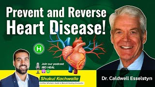 Dr Caldwell Esselstyn  Prevent and Reverse Heart Disease [upl. by Raouf]