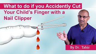 What to do if you Accidentally Cut Your Childs Finger with a Nail Clipper [upl. by Hays]