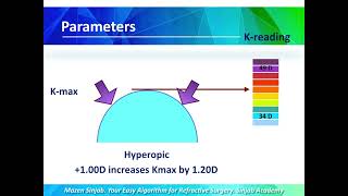 Concepts in Refractive Surgery  part1 [upl. by Nyltiac875]