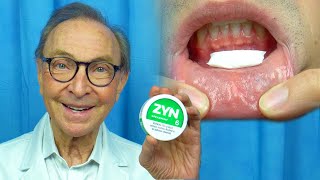 ZYN  Oral Health Risks and Benefits Reviewed by Dr Nemeth [upl. by Symon468]