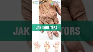 What are JAK Inhibitors used in treatment of Arthritis  Arthritis treatment in Hindi  Dr Gaurav [upl. by Anawal317]