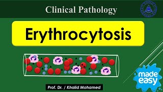 Vet Hematology Lecture 4 Erythrocytosis Polycythemia made easy [upl. by Sredna]