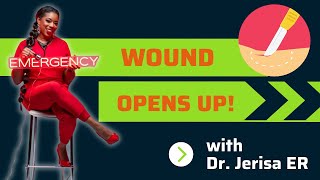 Surgery wound opens up Surgery suture comes out Emergency room care [upl. by Eceela]