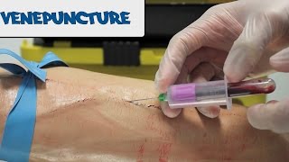 Venipuncture  How to take Blood  OSCE Guide old version  UKMLA  CPSA [upl. by Hajar]