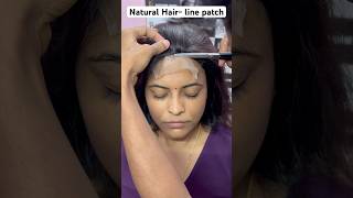 Natural Hair Line Patch Solutions You Need to See [upl. by Assiralk]