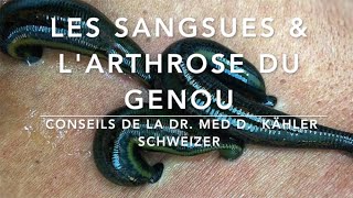 Les sangsues amp larthrose du genou Conseils de la Dr Med Kähler Schweizer Par M DRAKE [upl. by Anerhs585]