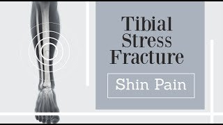 front shin pain  tibial stress fracture [upl. by Ledeen373]