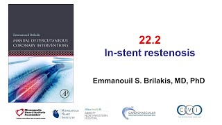 222 Instent restenosis Manual of PCI [upl. by Seigel996]