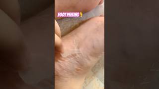 Satisfying foot peeling video shorts youtubeshorts skincare footpeel skincareroutine [upl. by Ihteerp]